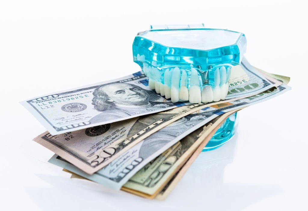cost of dental implants in Indiana