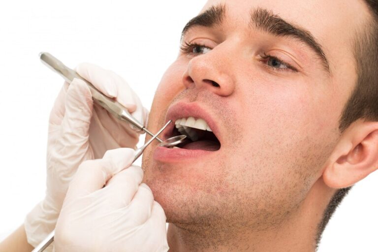 Tooth Removal