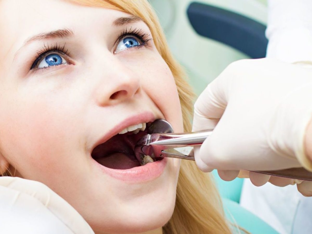 Scheduling Your Tooth Extraction