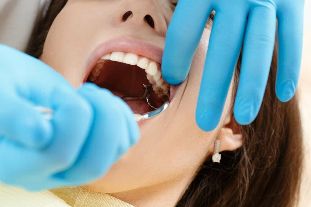 Everything You Should Know About Teeth Removal (Especially Wisdom Teeth!)